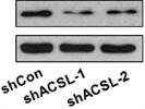 Good CDK4 Antibody for Western Blot