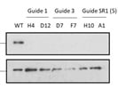 ACSS2 Antibody for Western Blot