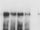 Great ErbB3 Antibody for Immunoprecipitation