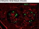 Excellent Antibody for CD31-Pecam-1 Immunostaining