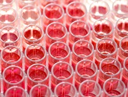 ELISA Detection Strategies