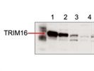 TRIM16/EBBP Antibody