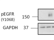 Great Phospho-EGF Receptor Antibody for Western Blotting