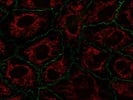 Mitochondrial Staining and Immunofluorescence Using MitoTracker Deep Red