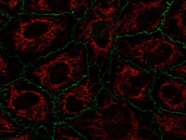 Mitochondrial Staining and Immunofluorescence Using MitoTracker Deep Red