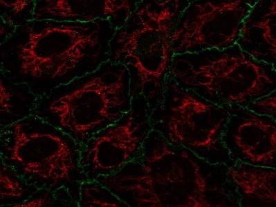 Mitochondrial Staining and Immunofluorescence Using MitoTracker Deep ...
