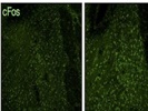 Good Antibody to Evaluate Neuronal Activity