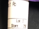 Western Blot on Fibroblast