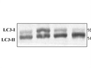 LC3 Antibody Works Well