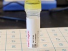 Good Antibody to Detect SOD1