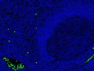 S100A9 Staining - Imaging Mass Cytometry (IMC)