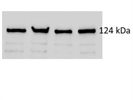 Reliable Antibody for High MW Loading Control