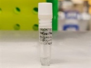 Excellent Antibody to Detect Collagen I