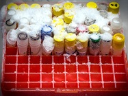 Lab Freezer Selection and Failure Prevention
