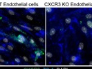 Good CXCR3 Antibody for Immunofluorescence