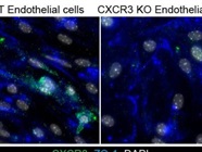 Good CXCR3 Antibody for Immunofluorescence