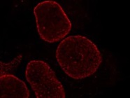 Great Antibody for Nuclear Pore Localization in ICC