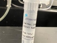 Time Course Effect of Chemoattractant on Rock1 Expression