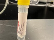 Time Course Effect of Chemoattractant on Rock2 Expression