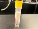 Time Course Effect of Chemoattractant on MAP2 Expression