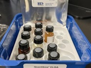 Easy to Use MCP-1 ELISA Kit