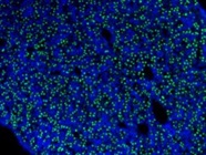 Good HNF-4alpha Antibody for Paraffine Embedded Tissue
