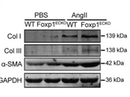 Anti-GAPDH Antibody from CST Works Well
