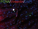CST Anti-PCNA Antibody Works Well