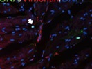 Good Anti-Vimentin Antibody from CST