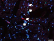 Vectashield Mounting Medium Containing DAPI Works Well
