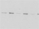 Great Phospho-ATP-Citrate Lyase Antibody, Very Clean Bands