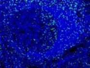 Bright CD45RO Staining - Imaging Mass Cytometry (IMC)