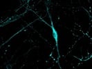 GAD655 Immunofluorescence-Cultured Neuron