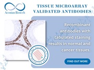 Maintain experimental uniformity with Tissue Microarray Validated Antibodies