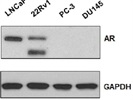 Good Androgen Receptor Antibody from Santa Cruz Biotechnology
