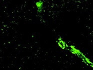 Good Avidin Antibody to Detect Biotin