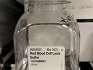 Lysis of Red Blood Cells in the Isolation of PBMCs