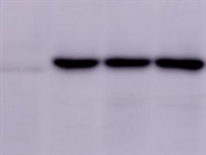 Good IRAK4 Antibody for Western Blot