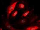 Poor Golgi Staining in Endothelial Cells