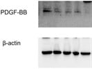 Novus Biologicals' PDGF-B Antibody Works Well