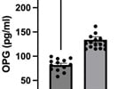 Reliable TNFRSF11B (OPG) Human ELISA Kit