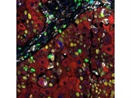 PathPlex® Panel 5 (CD3E, Cytokeratin, CD8 alpha, CD68, Ki-67, PD-L1)