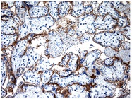 Avoiding Common Immunohistochemistry Mistakes