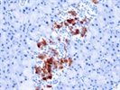 Perfect Antibody for Insulin