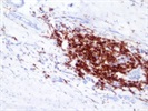 Great HLA-DR Antibody for Immunohistochemistry