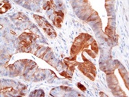 Clean and Sharp Immunohistochemical Staining with Beta Catenin Antibody