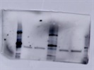Good IRP2 Antibody to Measure Labile Iron Pool