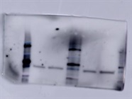 Good IRP2 Antibody to Measure Labile Iron Pool