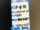 Good TGF-beta RI/ALK-5 Antibody for Western Blot