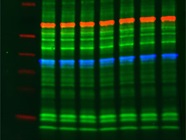 Western Blot Image Analysis